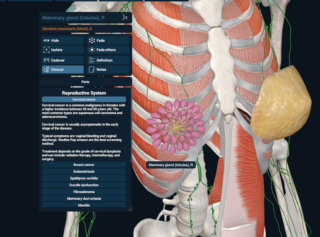 Clinical correlations feature demonstration on 3DO's Anatomy software