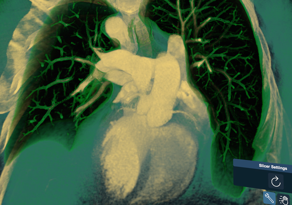 Featuring 3D Organon XR Imaging