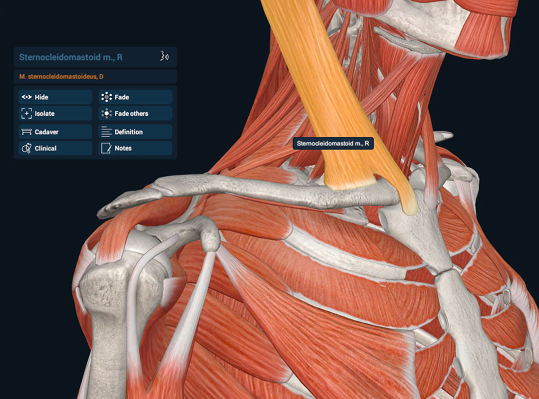 Muscular system demonstration on 3DO's Anatomy software