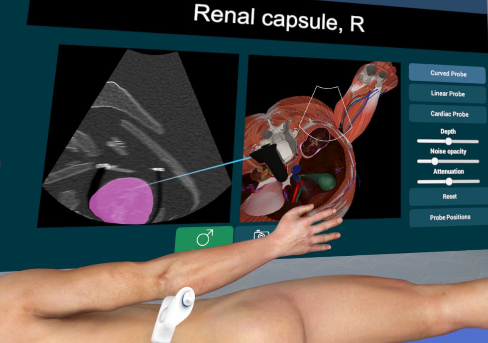 3D Organon Ultrasound simulator demonstration 