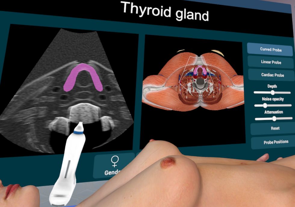 3D Organon Ultrasound simulator demonstration 