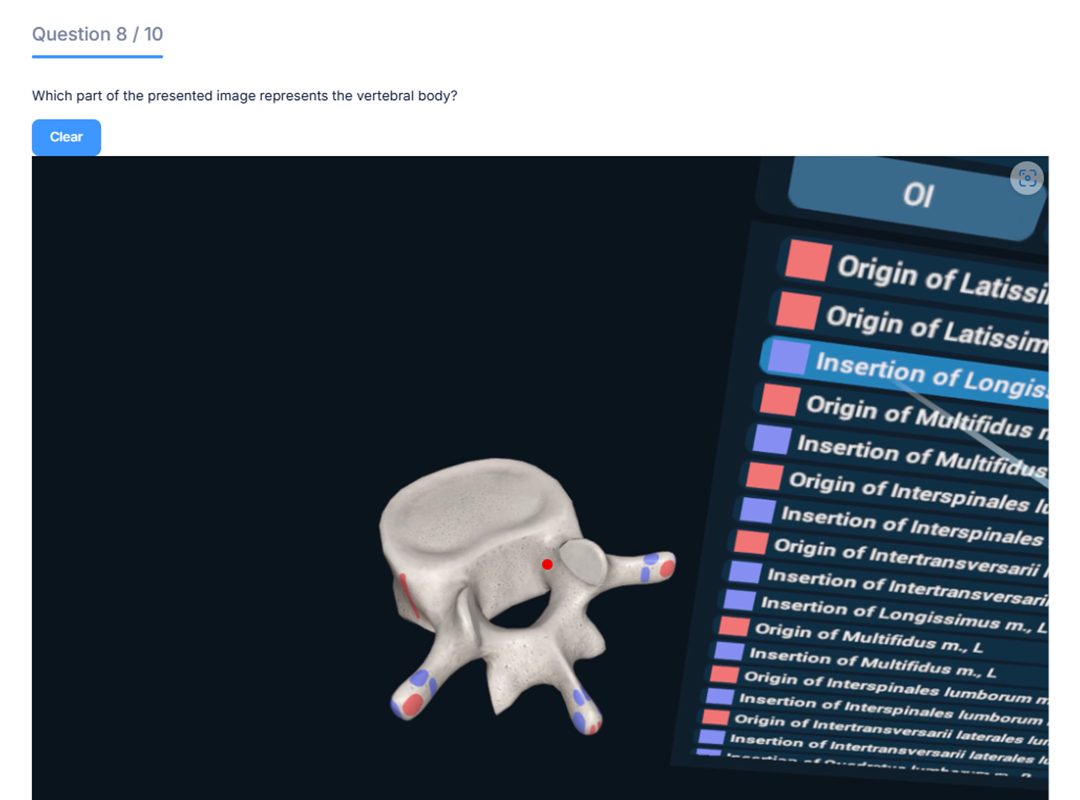 Screenshot of a multiple-choice question in 3D Organon Examverse, featuring an interactive 3D anatomy model. The interface displays the question, answer options, and navigation tools, highlighting Examverse’s immersive and dynamic assessment experience for professors and students.