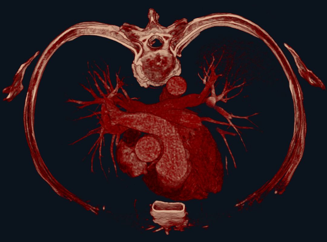 The XR Imaging module in 3D Organon XR promises to redefine how healthcare professionals interact with and understand patient data, offering a blend of advanced technology and practical application that is set to revolutionize the industry.